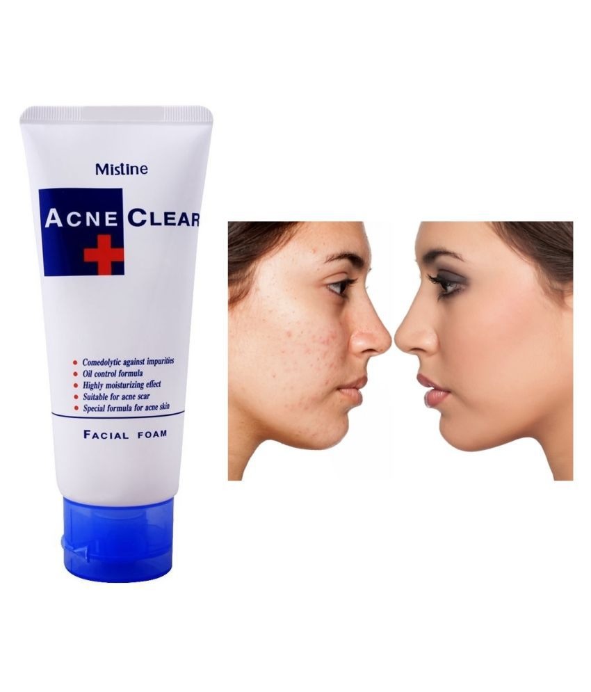 Acne Control Face Wash
